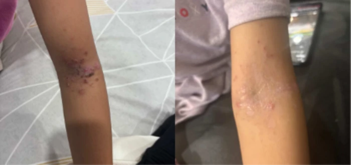 New Zealand customer tallow balm before and after results