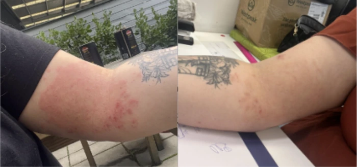 PrimalCare tallow balm NZ before and after