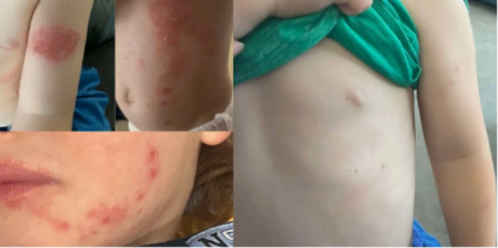 Tallow balm NZ review before after photo